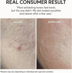 Arencia Glycolic Acid Exfoliating Toner