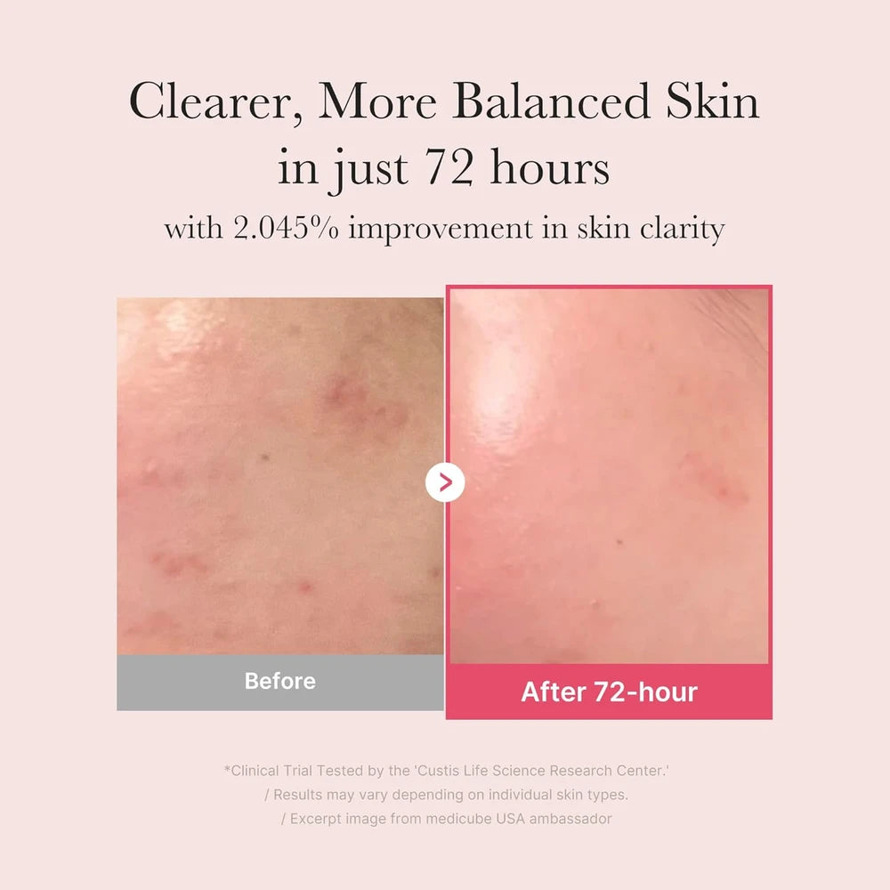Niacinamide Glow Serum