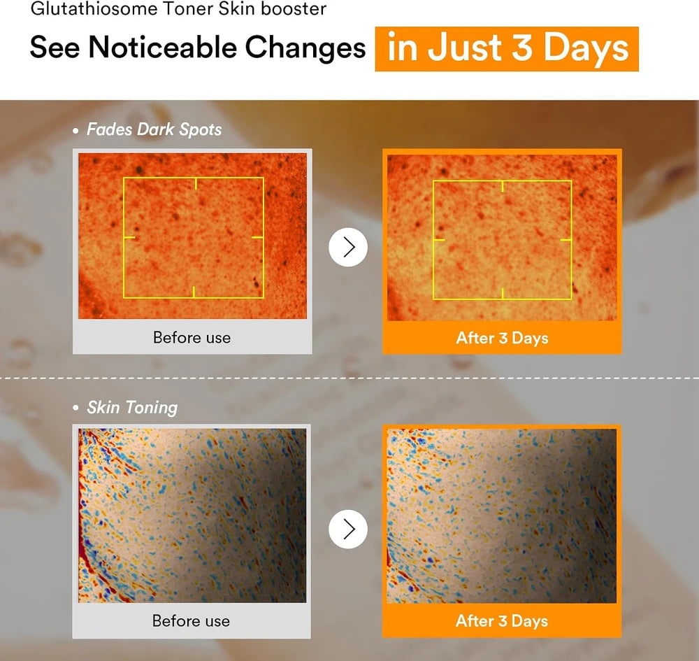 Abib Glutathiosome Dark Spot Toner