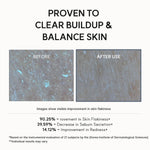 Arencia Eraser Shot Glycolic Acid Serum